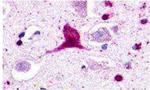GPR62 Antibody in Immunohistochemistry (Paraffin) (IHC (P))