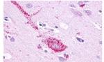 GPR61 Antibody in Immunohistochemistry (Paraffin) (IHC (P))