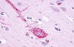 GPR61 Antibody in Immunohistochemistry (Paraffin) (IHC (P))