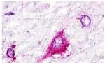 GPR22 Antibody in Immunohistochemistry (Paraffin) (IHC (P))