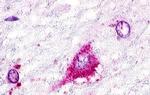 GPR22 Antibody in Immunohistochemistry (Paraffin) (IHC (P))