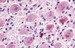 MRGPRX1 Antibody in Immunohistochemistry (Paraffin) (IHC (P))
