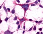 mGluR3 Antibody in Immunocytochemistry (ICC/IF)