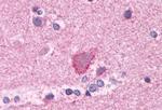 mGluR3 Antibody in Immunohistochemistry (Paraffin) (IHC (P))
