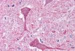 mGluR3 Antibody in Immunohistochemistry (Paraffin) (IHC (P))