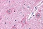 mGluR3 Antibody in Immunohistochemistry (Paraffin) (IHC (P))
