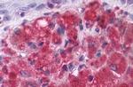 mGluR3 Antibody in Immunohistochemistry (Paraffin) (IHC (P))