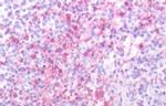 SSTR2 Antibody in Immunohistochemistry (Paraffin) (IHC (P))