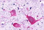 P2Y8 Antibody in Immunohistochemistry (Paraffin) (IHC (P))