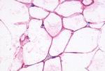 beta-3 Adrenergic Receptor Antibody in Immunohistochemistry (Paraffin) (IHC (P))