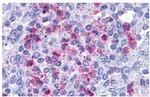LTB4R Antibody in Immunohistochemistry (Paraffin) (IHC (P))