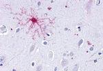 LTB4R Antibody in Immunohistochemistry (Paraffin) (IHC (P))