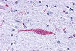 LTB4R Antibody in Immunohistochemistry (Paraffin) (IHC (P))