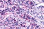 LTB4R Antibody in Immunohistochemistry (Paraffin) (IHC (P))