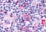 LTB4R Antibody in Immunohistochemistry (Paraffin) (IHC (P))