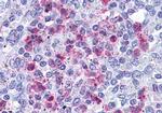 LTB4R Antibody in Immunohistochemistry (Paraffin) (IHC (P))