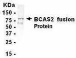 BCAS2 Antibody in Western Blot (WB)