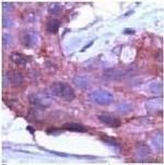 gamma Catenin Antibody in Immunohistochemistry (IHC)