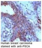 PSCA Antibody in Immunohistochemistry (IHC)