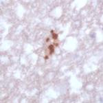 Toxoplasma gondii Antibody in Immunohistochemistry (IHC)