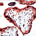 Bim Antibody in Immunohistochemistry (IHC)