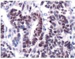 WT1 Antibody in Immunohistochemistry (IHC)