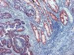 Protein APC Antibody in Immunohistochemistry (IHC)