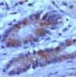 Protein APC Antibody in Immunohistochemistry (IHC)