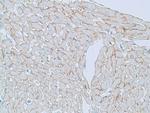 Dystrophin Antibody in Immunohistochemistry (Paraffin) (IHC (P))