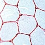 Dystrophin Antibody in Immunohistochemistry (IHC)