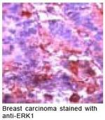 ERK1 Antibody in Immunohistochemistry (IHC)