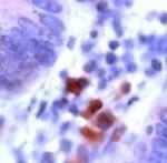 CD178 Antibody in Immunohistochemistry (IHC)