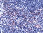 CD178 Antibody in Immunohistochemistry (IHC)