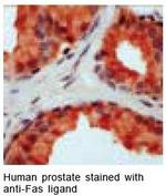 CD178 Antibody in Immunohistochemistry (IHC)