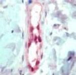 FLI1 Antibody in Immunohistochemistry (Paraffin) (IHC (P))