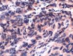 FLI1 Antibody in Immunohistochemistry (IHC)