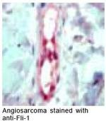 FLI1 Antibody in Immunohistochemistry (IHC)
