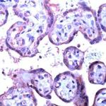 VEGF Receptor 2 Antibody in Immunohistochemistry (IHC)