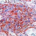 GLUT1 Antibody in Immunohistochemistry (IHC)