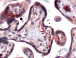 GLUT3 Antibody in Immunohistochemistry (IHC)