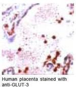 GLUT3 Antibody in Immunohistochemistry (IHC)