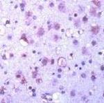 GSK3 alpha/beta Antibody in Immunohistochemistry (IHC)