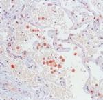 iNOS Antibody in Immunohistochemistry (IHC)