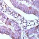 MCL1 Antibody in Immunohistochemistry (Paraffin) (IHC (P))