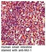 MCL1 Antibody in Immunohistochemistry (IHC)