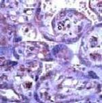MMP15 Antibody in Immunohistochemistry (Paraffin) (IHC (P))