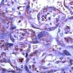 MMP15 Antibody in Immunohistochemistry (IHC)