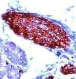 PGP9.5 Antibody in Immunohistochemistry (IHC)