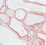 THRA Antibody in Immunohistochemistry (Paraffin) (IHC (P))
