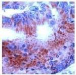 THRA Antibody in Immunohistochemistry (Paraffin) (IHC (P))